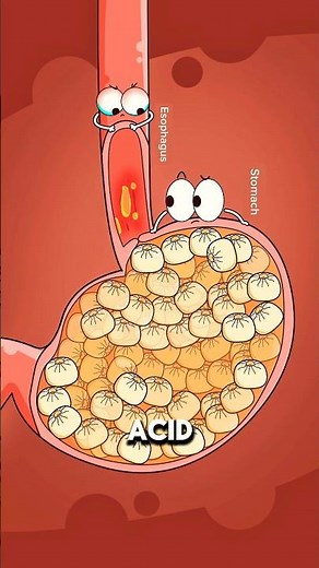 What Happens When You Ignore Acid Reflux for Years ⚠️..!!#e2dhealth #animation #2dshow #health #fypシ