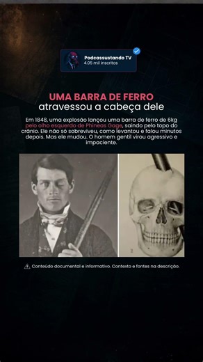 Phineas Gage (O Homem sem Cérebro) #shorts
