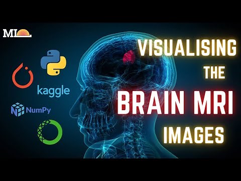 6-How to visualize our Brain MRI images?