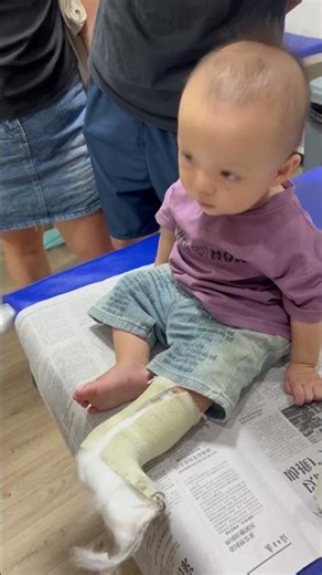 He Did Not Cry when his cast came off - Bangla