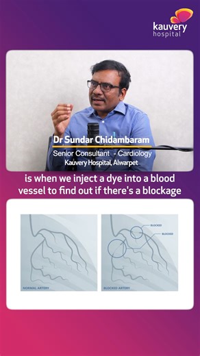 Kauvery Hospital on Instagram: "Angiograms are a key diagnostic tool that help visualize the heart’s blood vessels and detect potential blockages or abnormalities. Dr. Sundar Chidambaram, Senior Consultant – Cardiology at Kauvery Hospital Alwarpet, explains how this procedure plays a vital role in preventing heart complications and guiding timely treatment. #KauveryHospital #KauveryHospitalChennai #KauveryHospitalAlwarpet #Angiogram #HeartHealth #Cardiology #HeartCheckup #PreventHeartDisease #He