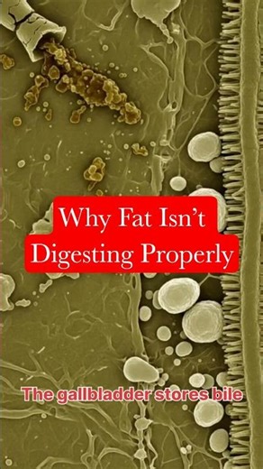 Gallbladder Function Explained|How Bile Timing Affects Fat Digestion #gallbladderhealth