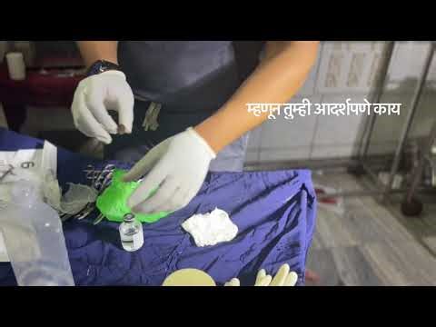 What To Do After Finger or Toe Amputation | Emergency First Aid Awareness