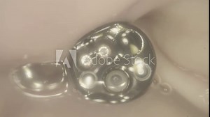 Endoscope inside the stomach.