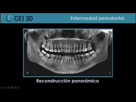 Webinar Tomografía Cone Beam y sus aplicaciones en Odontología
