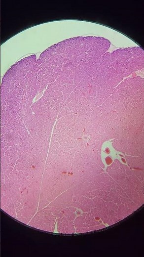 Pancreas at 25x, 40x, 100x, 200x and 400x magnification | Pancreas under the microscope 🔬