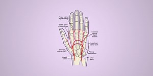 Arterial Puncture - RNpedia