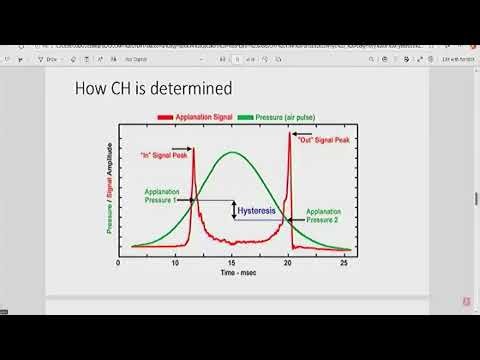 Pachymetry or Hysteresis in Glaucoma Management By Dr. Tarela F. Sarimiye