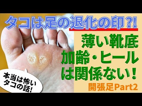 Pain in the soles of your feet! Root cause relief for calluses and corns! A shoe expert will teac...