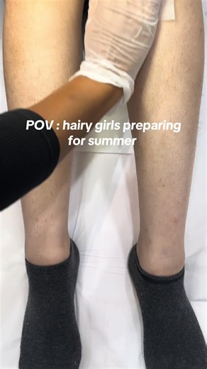 Effective Laser Hair Removal for Strawberry Legs