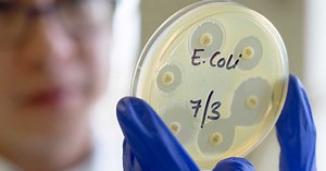 Bactérie E. Coli (Escherichia coli) : quels sont les symptômes et que risque-t-on ?