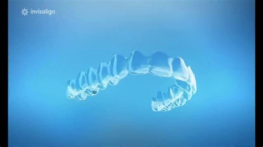 Invisalign TV Spot, 'Allison's Transformation'