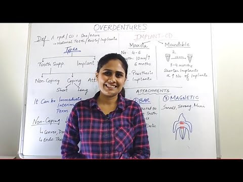 Overdentures | Prosthodontics