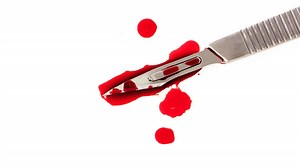 Excision : quelles conséquences physiques et psychologiques sur la femme ?