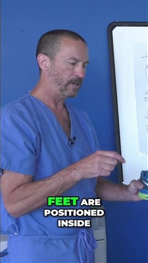 Unlocking Foot Health: The Surprising Truth About Toe Spring #shorts