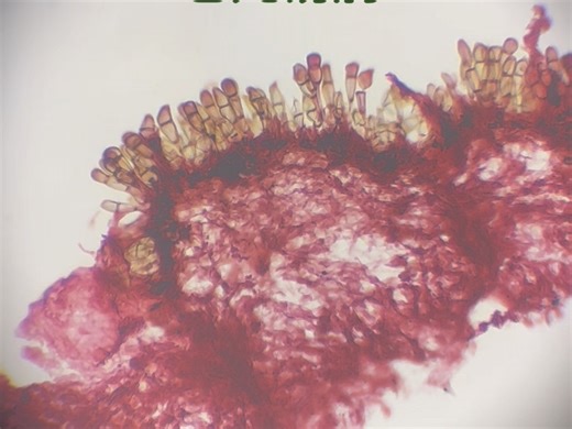 苍儿锈病 柄锈菌属真菌玻片 生物切片 植物病理显微玻片 植物病害病原物显微镜下观察真菌特征 高校 学生 科教 河南·新乡绿保植物病虫害标本工作室监制研发中心制作