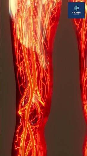 Warning Signs of a Blood Clot in the Leg: Recognize the Symptoms!