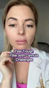 Tear Trough Filler cannula technique and how to select the right product and the right patient
