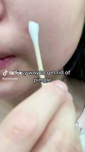 Easy Way to Shrink Pimple with Toothpaste