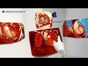 What is Medicalholodeck?