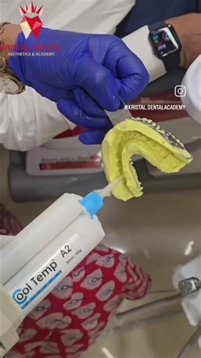 Introducing the DEXIS Intraoral Scanner | Digital Dentistry at Kristal Dental