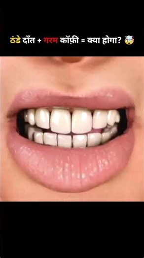 Can Cold Teeth Explode From Hot Coffee? 😳