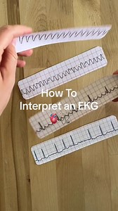 208K views · 2.6K reactions | – EKG Interpretation – EKG strips can...