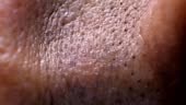 Close up of Human Skin Texture