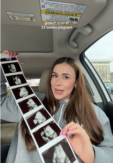 33 Weeks Pregnant Growth Scan Journey