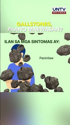 Mga dapat malaman upang maiwasan ang gallstones