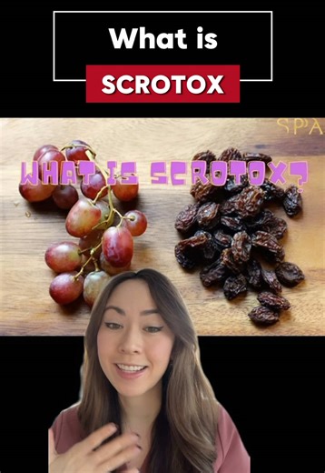 Why do some men get Scrotox? Let’s talk about it. Scrotox is exactly what it sounds like — Botox for the scrotum. A few quick injections relax the dartos muscle (a thin layer of smooth muscle under the skin), which can make things look a little smoother, hang a little lower, and for some men, feel less tight or sweaty. It’s off-label, temporary (about 3–4 months), and mostly done for aesthetic reasons. If someone chooses to get it, just make sure it’s performed by an experienced injector. Defini