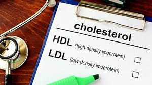 How does LDL cholesterol impact heart heath? 4 things to know (and how to lower it)