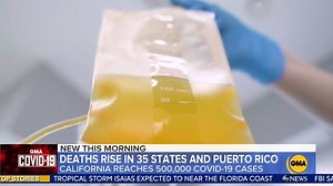120K views · 305 reactions | COVID-19 hospitalizations increase across 35 states. California reaches 500,000 cases of coronavirus and 10 states hit a record number of deaths after the total number of coronavirus cases in the U.S. rose to more than 4.6 million. https://gma.abc/2Xk9lHj | Good Morning America | Facebook