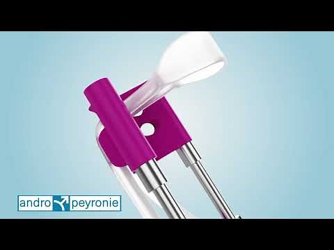 Penile traction device for #Peyroniesdisease