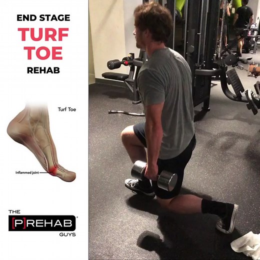 Comprehensive Turf Toe Rehabilitation Techniques