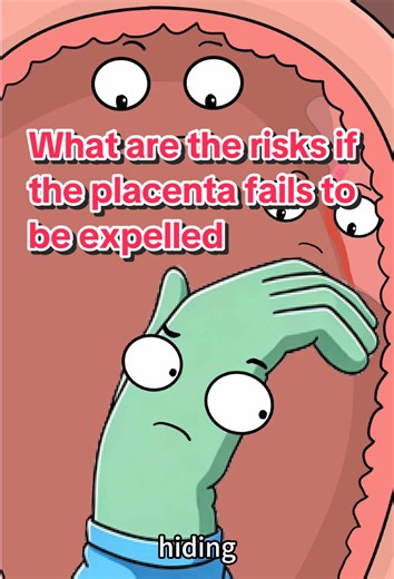 What are the risks if the placenta fails to be expelled?🧐👶🥹🥹🫣😂#health #animation