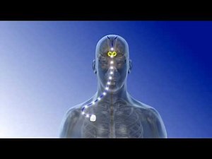 Deep Brain Stimulation - 3D Animation || ABP ©