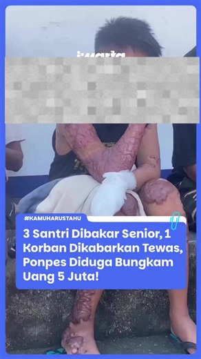 Kasus dugaan pembakaran tiga santri di Lombok Tengah, NTB, terjadi pada November 2025 (perlu dipastikan), diduga dilakukan oleh seorang santri senior setelah para korban melaporkan perilaku santri senior tersebut kepada pihak pesantren, sehingga pelaku menyimpan dendam dan menyiram bahan bakar sebelum membakar ketiga korban. Dua korban mengalami luka bakar serius, sedangkan satu korban meninggal dunia.