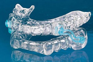 Custom Snore Guards Raleigh NC | Dentist-Recommended Relief