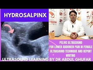 Hydrosalpinx ultrasound | fallopian tube ultrasound | Ovary ultrasound | pelvic ultrasound in female