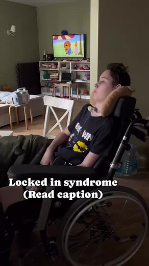 Understanding Locked-In Syndrome: Types and Recovery
