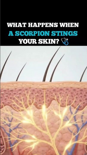 WHAT HAPPENS WHEN A SCORPION STINGS YOUR SKIN? 🩺#ScorpionSting #Venom #MedicalAnimation #Toxicology