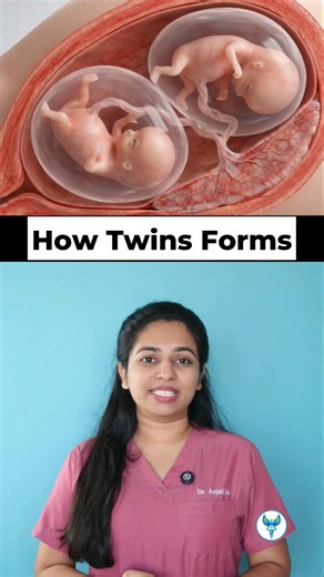How Twins are Formed: Identical vs Fraternal Pregnancy #twins