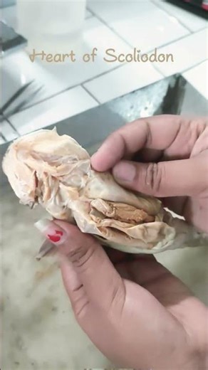 Scoliodon (Cartilaginous Fish), Heart of scolinodon ( triangular shape )