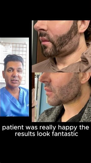 Non surgical Neck lift