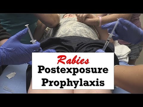 How to Inject Rabies Vaccine and Immunoglobulin
