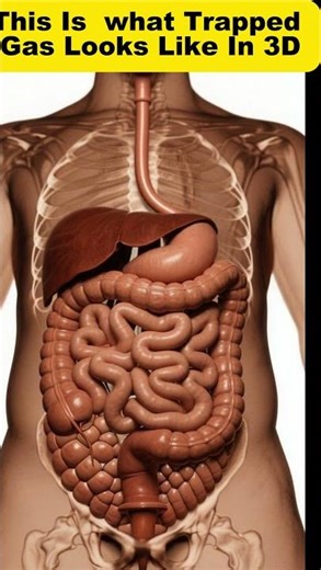 Your Colon Under Pressure: What Trapped Gas Looks Like in 3D