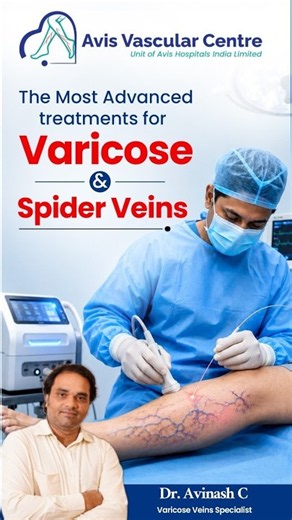 The Most Advanced Treatments for Varicose & Spider Veins | Dr. Avinash