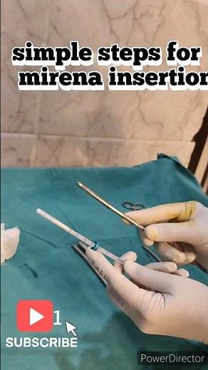 #mirena iucd#how to insert mirena #hormonal iucd#levonorgestrol#endometriosis #adenomyosis#iucd