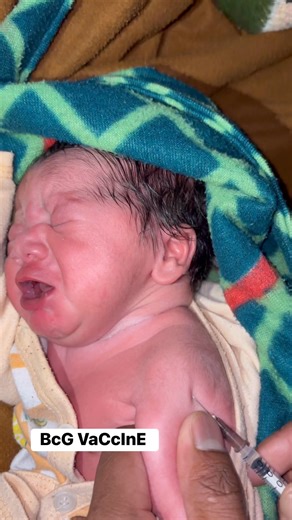 Vikash Jaat on Instagram: "At birth vaccine #bcg BCG (Bacillus Calmette–Guérin) • It’s a vaccine against tuberculosis (TB) • Given mainly to newborns/infants in countries like India • Protects especially against severe TB (TB meningitis, miliary TB) in children • It does not fully prevent adult pulmonary TB, but reduces severity • Scar: A small scar on the upper arm is normal • Test interference: BCG can cause a false-positive Mantoux (TB skin test) • Duration: Protection wanes over time (not li